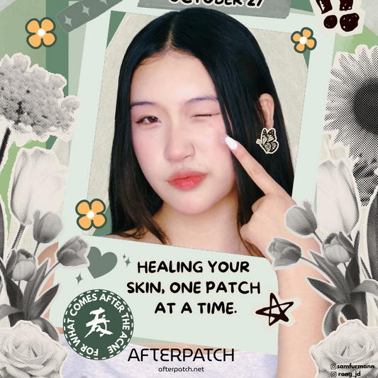 Promotional graphic for Afterpatch with a person pointing to their face, surrounded by floral and leaf designs.